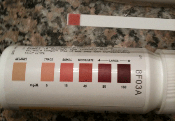 This was my ketostix result five days into my CKD 